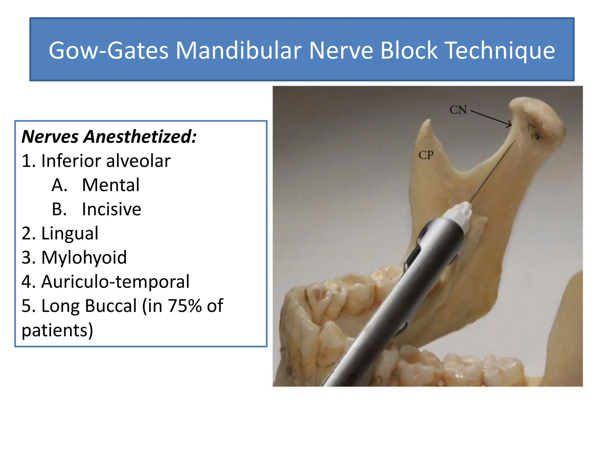 mandibular techniques in your area are here | PDF
