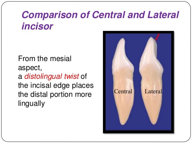 lateral incisor