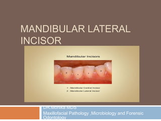 MANDIBULAR LATERAL
INCISOR
DR.Monika MDS
Maxillofacial Pathology ,Microbiology and Forensic
Odontology
 
