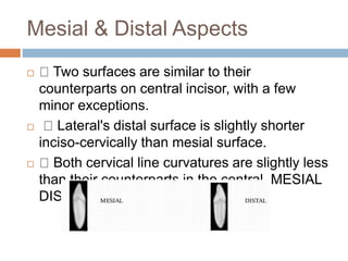 Mesial & Distal Aspects
 Two surfaces are similar to their
counterparts on central incisor, with a few
minor exceptions.
 Lateral's distal surface is slightly shorter
inciso-cervically than mesial surface.
 Both cervical line curvatures are slightly less
than their counterparts in the central. MESIAL
DISTAL
 