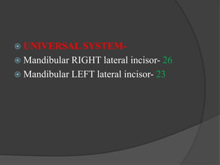  UNIVERSAL SYSTEM-
 Mandibular RIGHT lateral incisor- 26
 Mandibular LEFT lateral incisor- 23
 