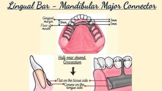 Mandibular major connector _20251004_085247_0000.pptx