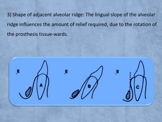 3) Shape of adjacent alveolar ridge: The lingual slope of the alveolar
ridge influences the amount of relief required, due to the rotation of
the prosthesis tissue-wards.

 