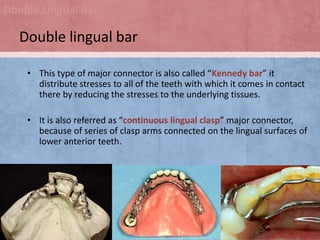 Double Lingual Bar

Double lingual bar
• This type of major connector is also called “Kennedy bar” it
distribute stresses to all of the teeth with which it comes in contact
there by reducing the stresses to the underlying tissues.
• It is also referred as “continuous lingual clasp” major connector,
because of series of clasp arms connected on the lingual surfaces of
lower anterior teeth.

 