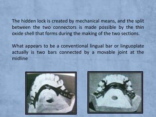 The hidden lock is created by mechanical means, and the split
between the two connectors is made possible by the thin
oxide shell that forms during the making of the two sections.
What appears to be a conventional lingual bar or linguoplate
actually is two bars connected by a movable joint at the
midline

 