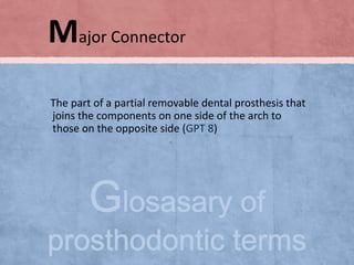 Major Connector
The part of a partial removable dental prosthesis that
joins the components on one side of the arch to
those on the opposite side (GPT 8)

 