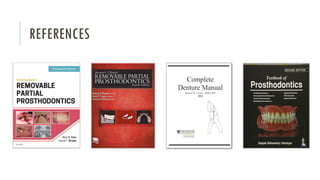 Mandibular Major Connectors | PDF