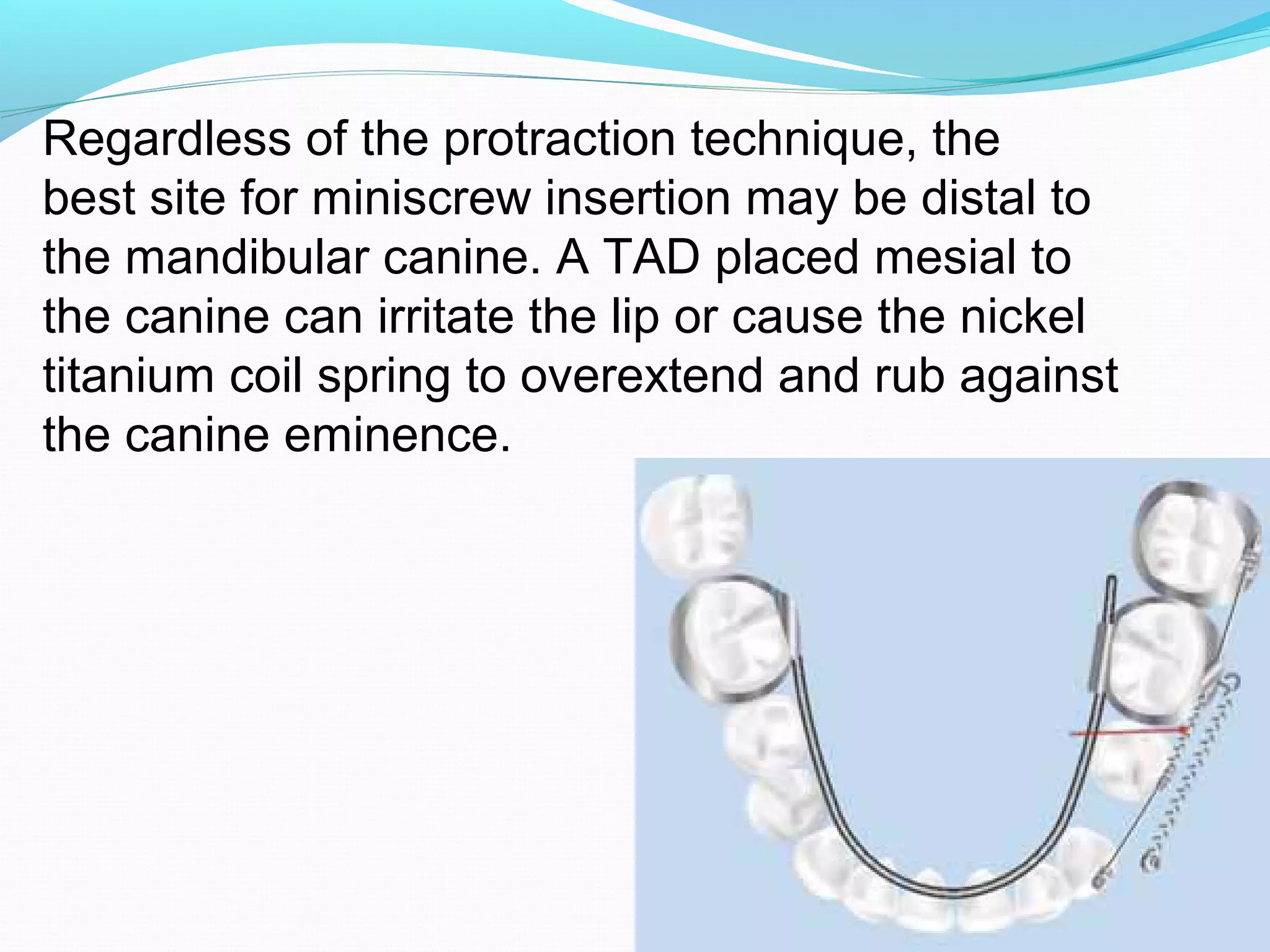 Mandibular molar protraction | PPT