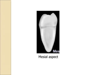 Mesial aspect 