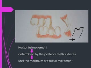 mechanics of Mandibular movement | PPTX