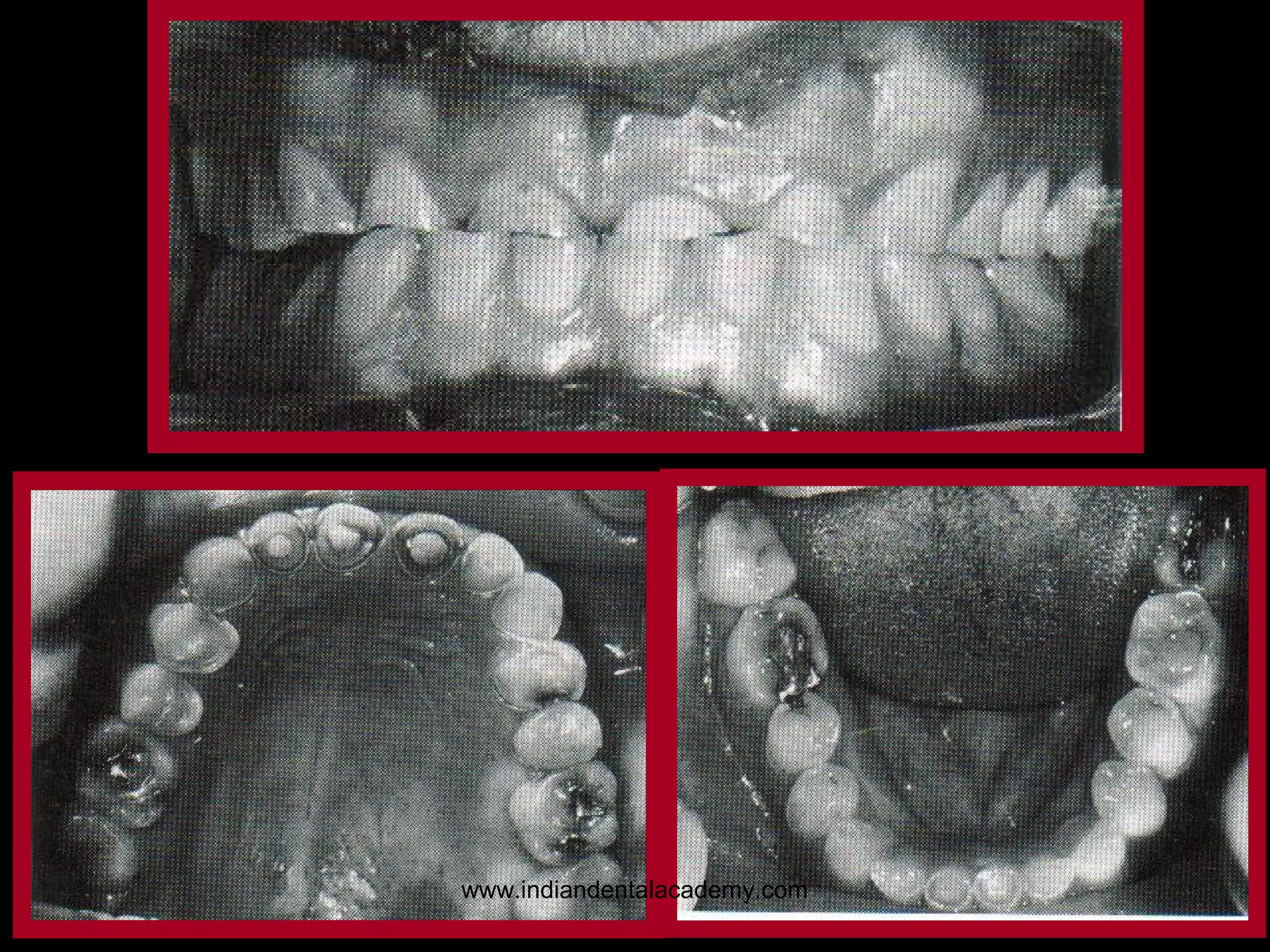 www.indiandentalacademy.com

103

 