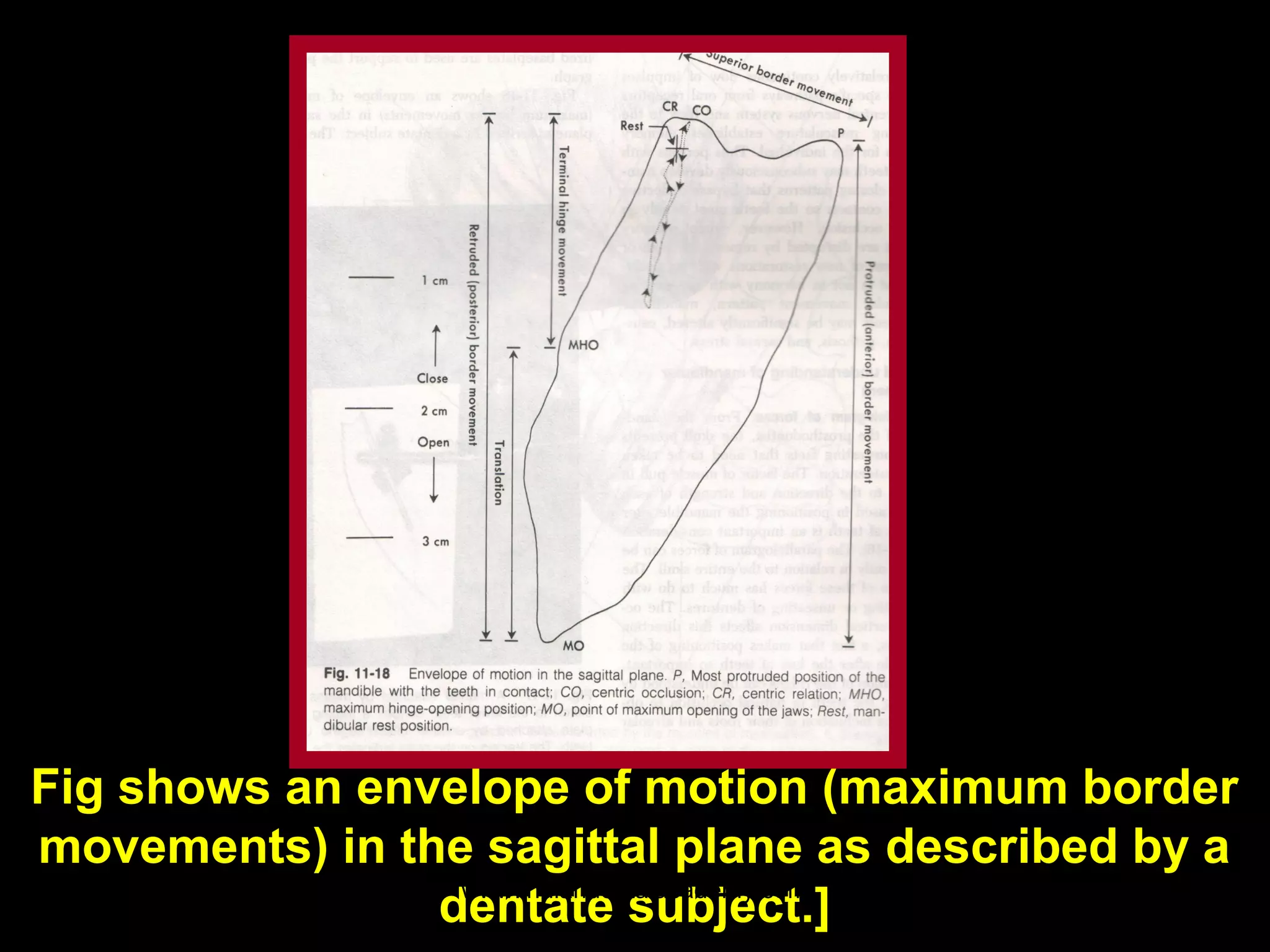 Fig shows an envelope of motion (maximum border
movements) in the sagittal plane as described by a
www.indiandentalacademy.com
122
dentate subject.]

 