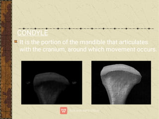 CONDYLE
It is the portion of the mandible that articulates
with the cranium, around which movement occurs.
 