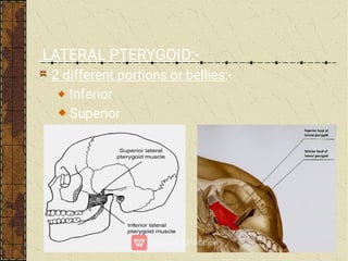 LATERAL PTERYGOID:-
2 different portions or bellies:-
Inferior
Superior
 