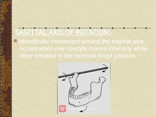 SAGITTAL AXIS OF ROTATION:-
Mandibular movement around the sagittal axis
occurs when one condyle moves inferiorly while
other remains in the terminal hinge position.
 