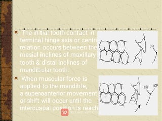 The initial tooth contact in
terminal hinge axis or centric
relation occurs between the
mesial inclines of maxillary
tooth & distal inclines of
mandibular tooth.
When muscular force is
applied to the mandible,
a superoanterior movement
or shift will occur until the
intercuspal position is reached.
 