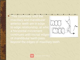 This continues until the
maxillary and mandibular
anterior teeth are in edge
to edge relationship, at which
a horizontal movement
continues until incisal edges
of mandibular teeth pass
beyond the edges of maxillary teeth.
 