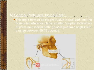 b) Sagittal Protrusive Incisal Path:-
The angle formed by the protrusive incisal path and the
horizontal reference plane is called “sagittal inclination
of protrusive incisal path” (incisal guidance angle) with
a range between 50-70 degrees.
 
