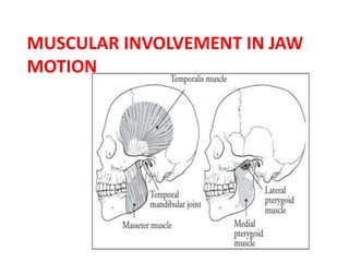 MUSCULAR INVOLVEMENT IN JAW
MOTION
 