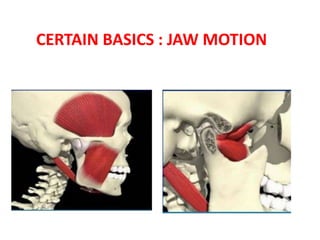 CERTAIN BASICS : JAW MOTION
 