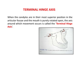 TERMINAL HINGE AXIS
When the condyles are in their most superior position in the
articular fossae and the mouth is purely rotated open, the axis
around which movement occurs is called the ‘Terminal Hinge
Axis’.
 