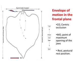 Envelope of
motion in the
frontal plane
•CO, Centric
occlusion
•MO, point of
maximum
opening of the
jaws
• Rest, postural
rest position.
 