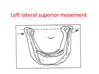 Left lateral superior movement
 