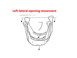 Left lateral opening movement
 