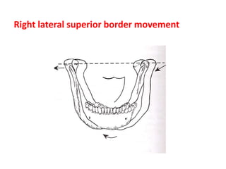 Right lateral superior border movement
 