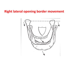 Right lateral opening border movement
 