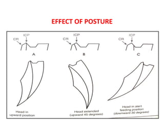 EFFECT OF POSTURE
 
