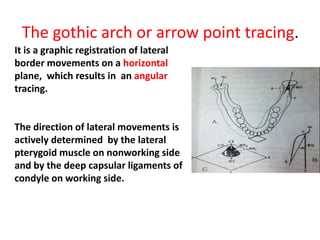 The gothic arch or arrow point tracing.
It is a graphic registration of lateral
border movements on a horizontal
plane, which results in an angular
tracing.
The direction of lateral movements is
actively determined by the lateral
pterygoid muscle on nonworking side
and by the deep capsular ligaments of
condyle on working side.
 