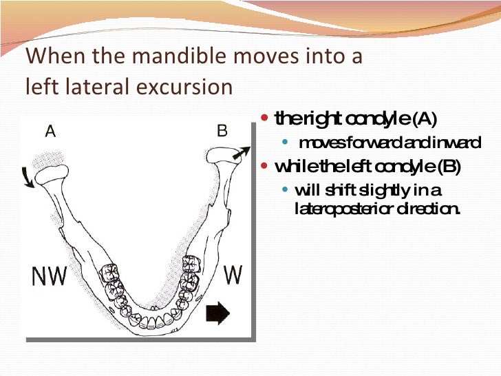 Mandibular Bocher
