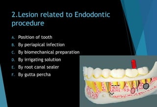 2.Lesion related to Endodontic
procedure
A. Position of tooth
B. By periapical infection
C. By biomechanical preparation
D. By irrigating solution
E. By root canal sealer
F. By gutta percha
 