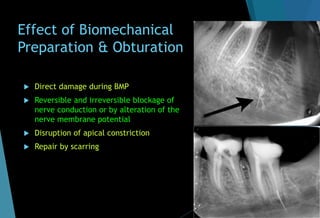Effect of Biomechanical
Preparation & Obturation
 Direct damage during BMP
 Reversible and irreversible blockage of
nerve conduction or by alteration of the
nerve membrane potential
 Disruption of apical constriction
 Repair by scarring
 