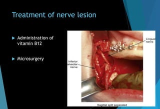 Treatment of nerve lesion
 Administration of
vitamin B12
 Microsurgery
 