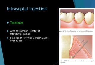 Intraseptal injection
 Technique
 Area of insertion – center of
interdental papilla
 Stabilize the syringe & inject 0.2ml
over 20 sec
 