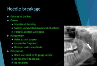 Needle breakage
 Occures at the hub
 Causes
 Intentional bending
 Sudden unexpected movement of patient
 Forceful contact with bone
 Management
 Refer to oral surgeon
 Locate the fragment
 Remove under anesthesia
 Prevention
 Don’t use short or 30 gauge needle
 Do not insert to its hub
 Do not bend
 