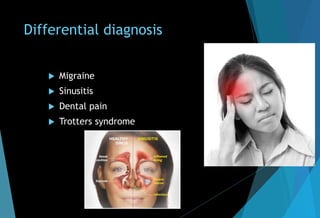Differential diagnosis
 Migraine
 Sinusitis
 Dental pain
 Trotters syndrome
 