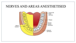 MANDIBULAR NERVE BLOCKS and techniques in dentistry | PPTX