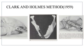 MANDIBULAR NERVE BLOCKS and techniques in dentistry | PPTX