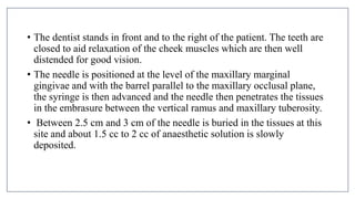 MANDIBULAR NERVE BLOCKS and techniques in dentistry | PPTX