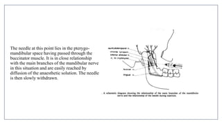 MANDIBULAR NERVE BLOCKS and techniques in dentistry | PPTX