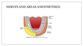 MANDIBULAR NERVE BLOCKS and techniques in dentistry | PPTX