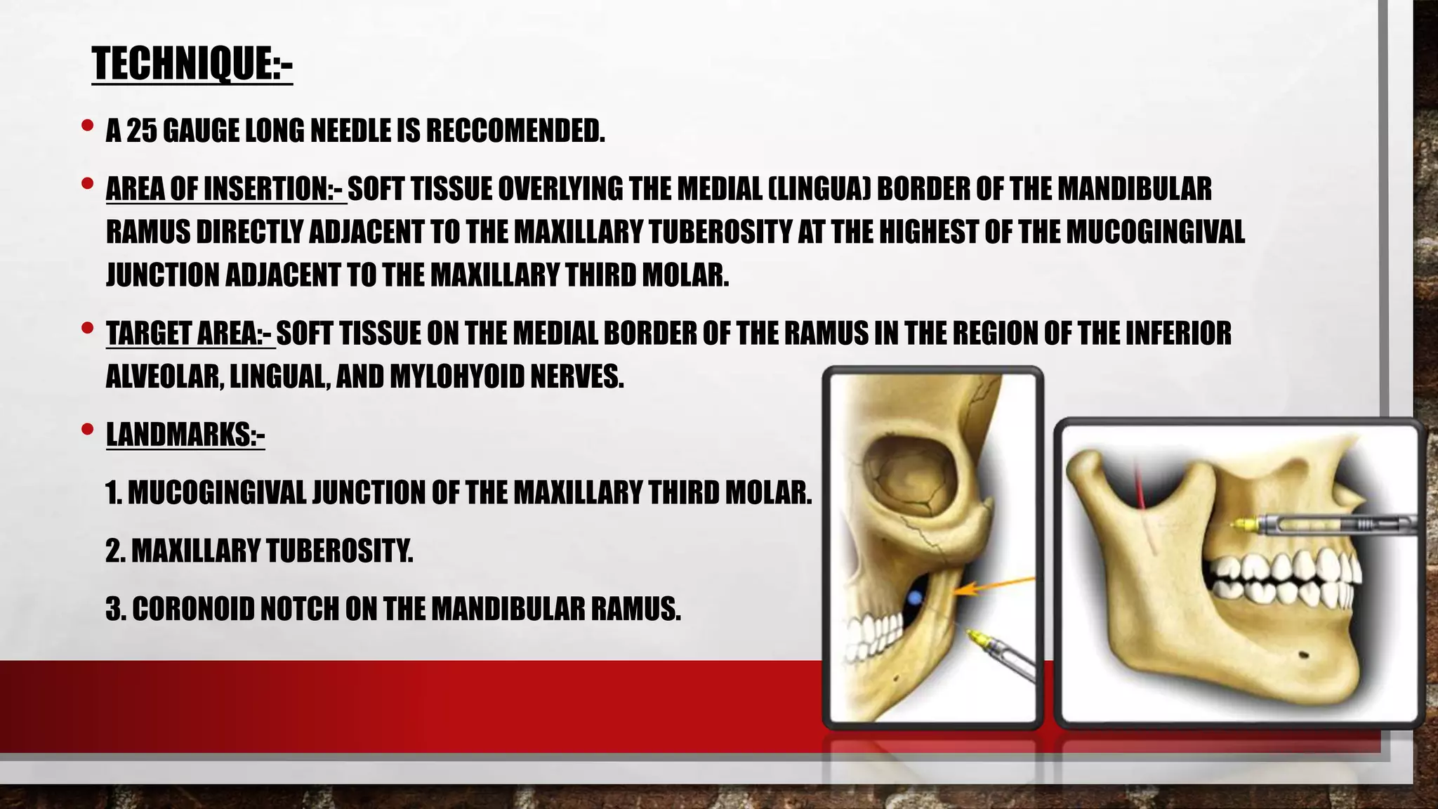 MANDIBULAR NERVE BLOCK TECHNIQUES | PPTX