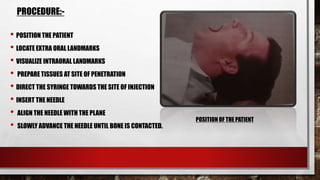 MANDIBULAR NERVE BLOCK TECHNIQUES | PPTX