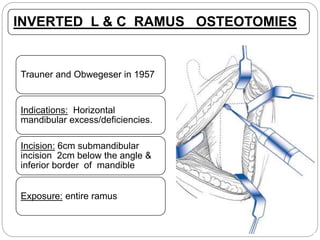 INVERTED L & C RAMUS OSTEOTOMIES
Trauner and Obwegeser in 1957
Indications: Horizontal
mandibular excess/deficiencies.
Incision: 6cm submandibular
incision 2cm below the angle &
inferior border of mandible
Exposure: entire ramus
 