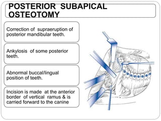 POSTERIOR SUBAPICAL
OSTEOTOMY
Correction of supraeruption of
posterior mandibular teeth.
Ankylosis of some posterior
teeth.
Abnormal buccal/lingual
position of teeth.
Incision is made at the anterior
border of vertical ramus & is
carried forward to the canine
 