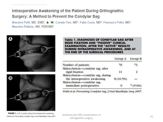 mandibular orthognathic procedures II- ih