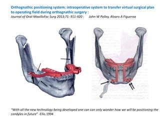 mandibular orthognathic procedures II- ih